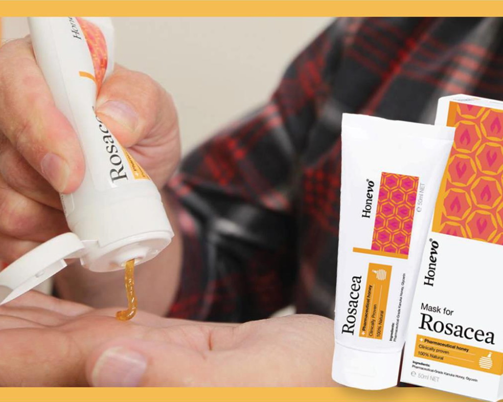 Honevo Rosacea  Product | Honeylab NZ